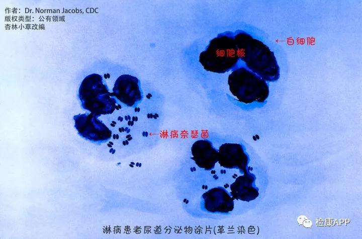 如图所示，淋病奈瑟菌是一种双球菌（成双成对出现的球形椭球形细菌）。.jpg