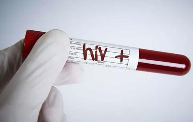 HIV病毒载量