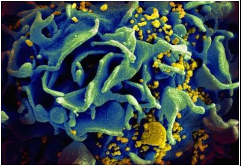 关于受HIV感染的T细胞的扫描电镜图，图片来自NIAID。
